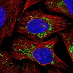 TCIRG1 Antibody, Novus Biologicals 0.1mL; Unlabeled:Antibodies, Polyclonal